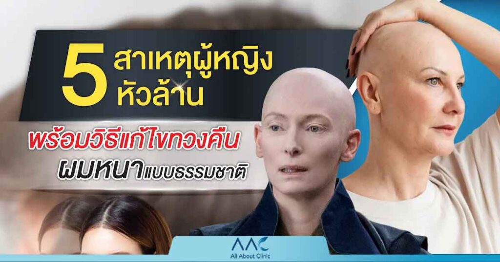 ผู้ฆญิง หัวล้าน สาเหตุ