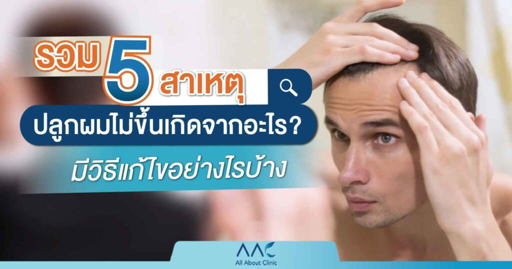ปลูกผมไม่ขึ้น