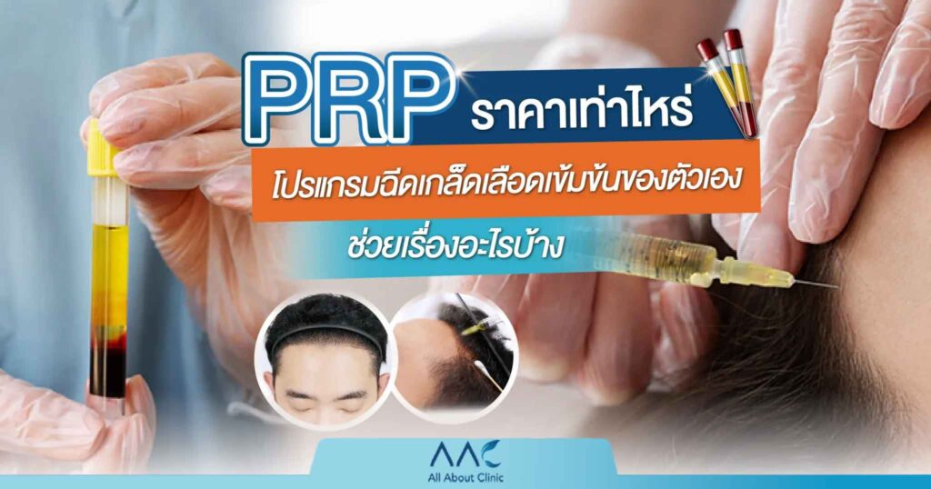prp ราคา