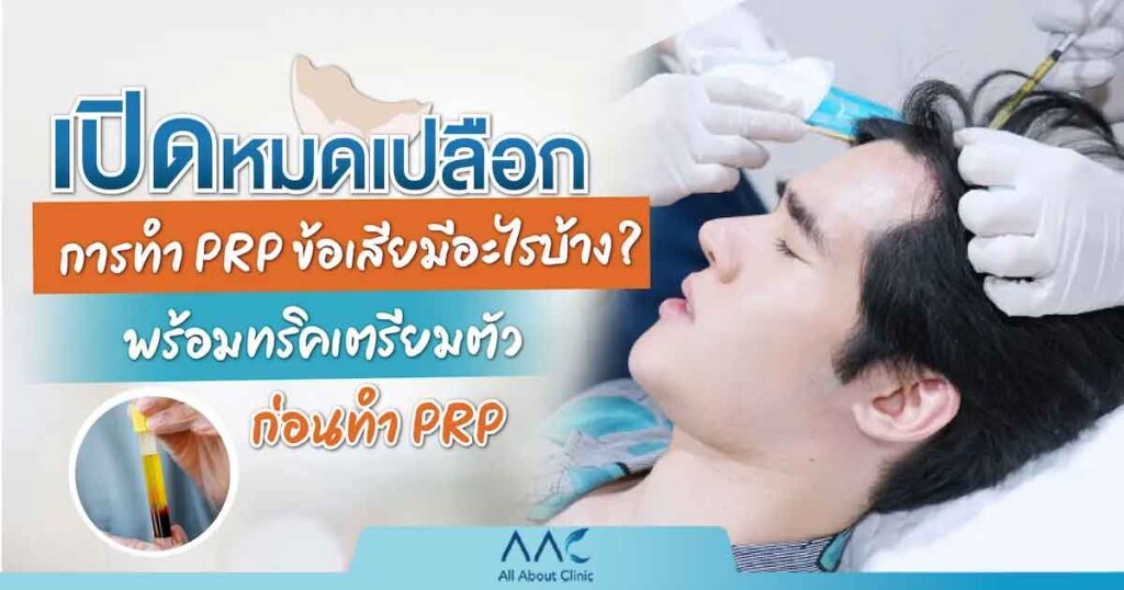 prp