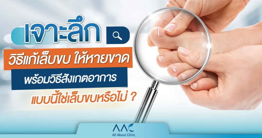 วิธี เล็บขบ