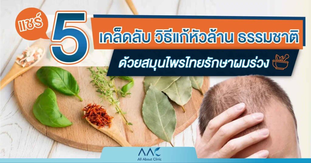 วิธีแก้หัวล้าน
