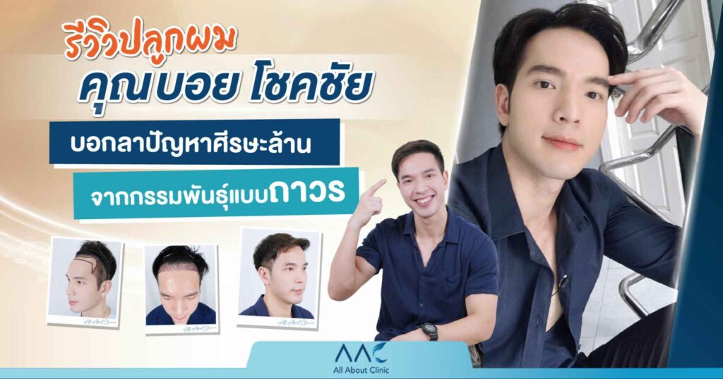 บอย โชคชัย
