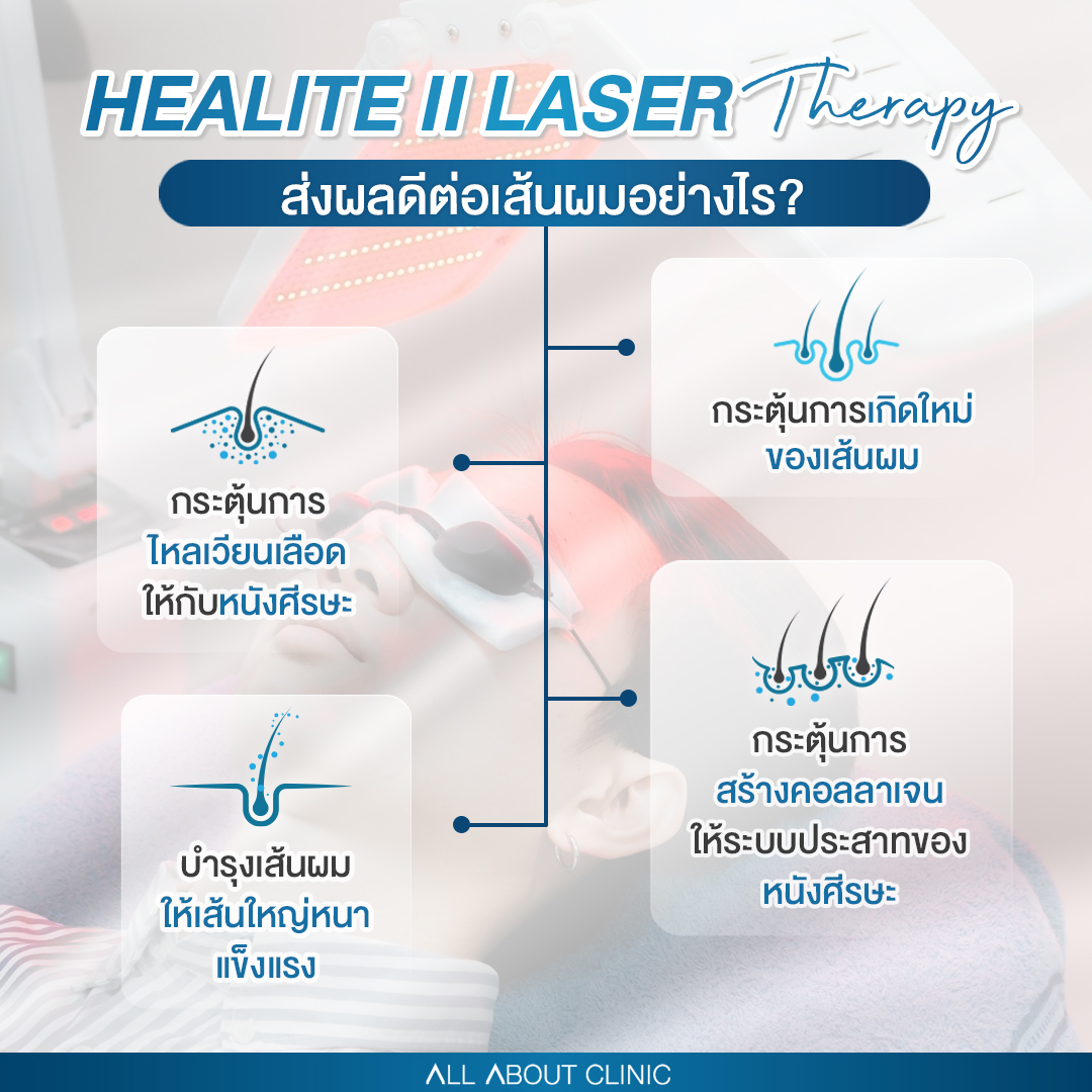 เลเซอร์ลดผมร่วงดียังไง