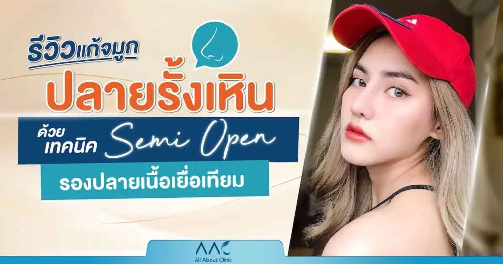 รีวิวแก้จมูก