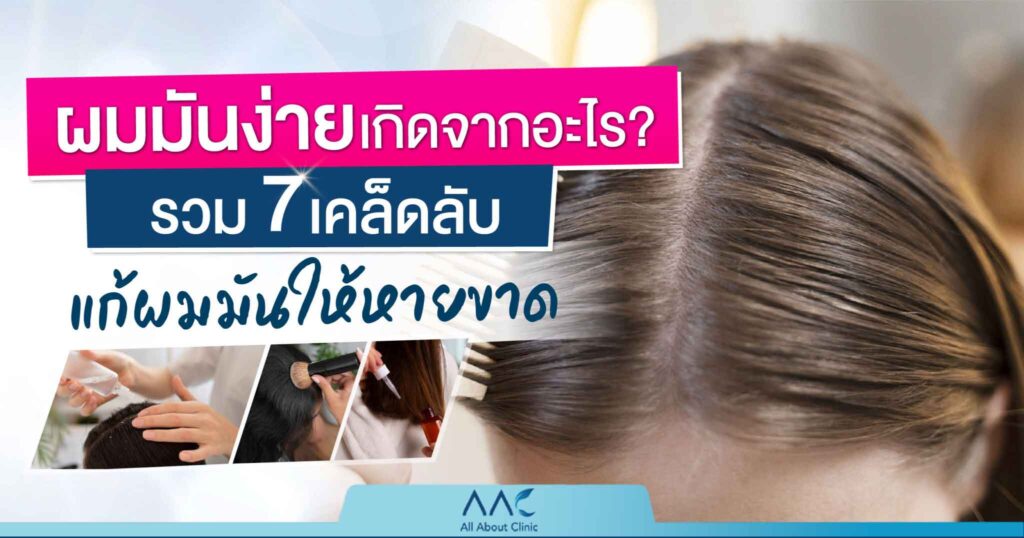 ผมมันง่าย