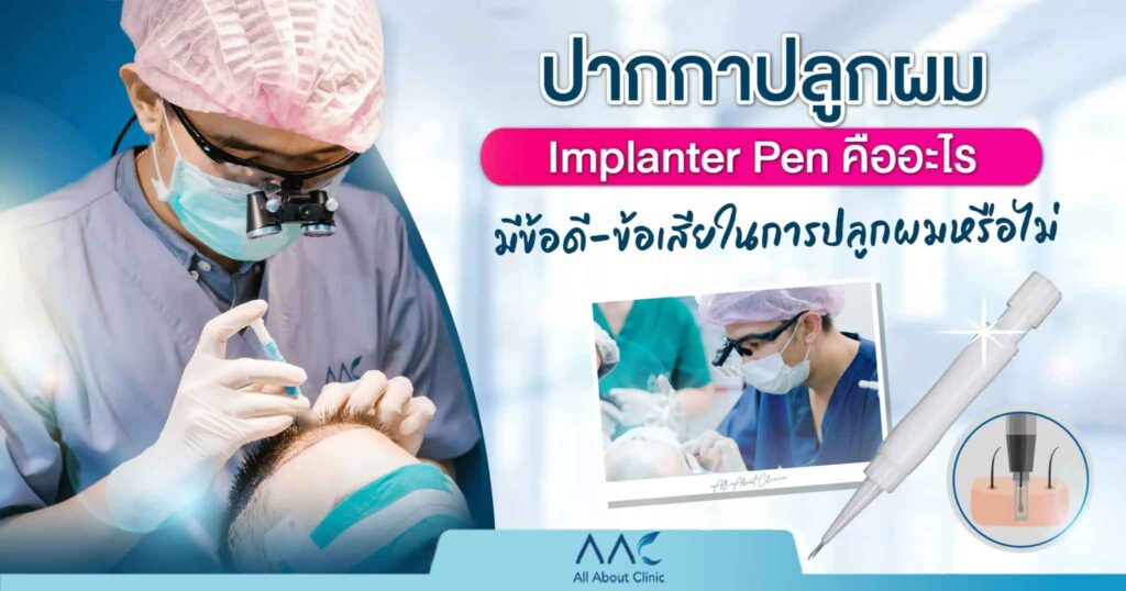 ปากกาปลูกผม