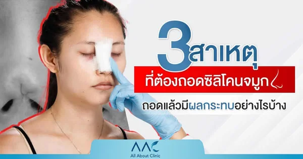 ถอดซิลิโคตจมูก