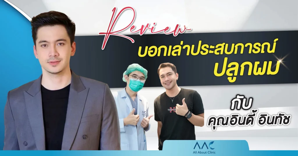 ประสบการณ์ ปลูกผม