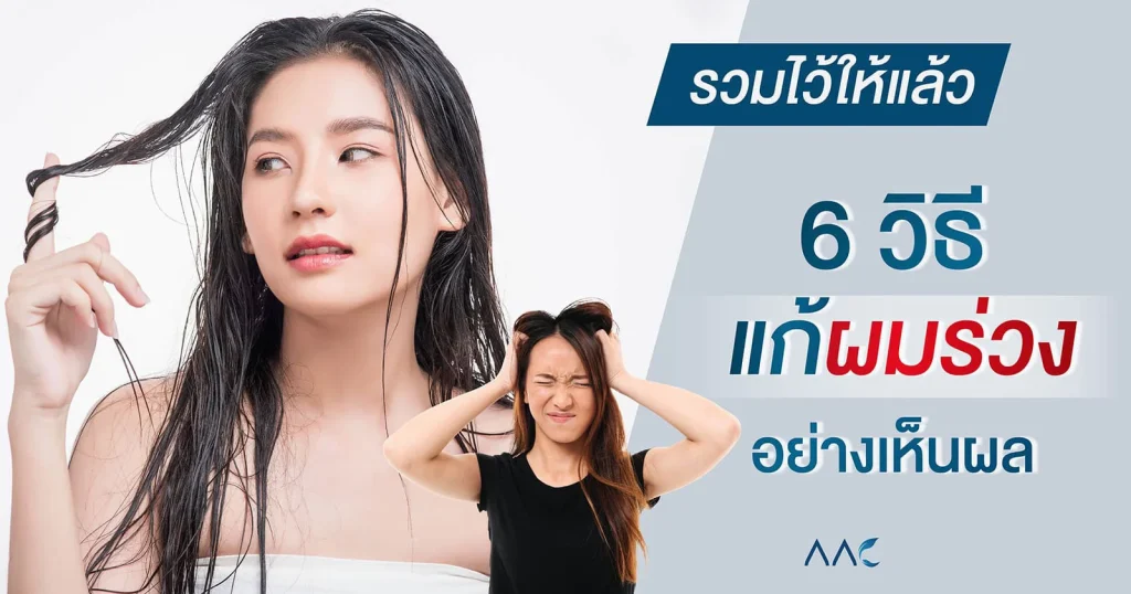 วิธีแก้ ผมร่วง