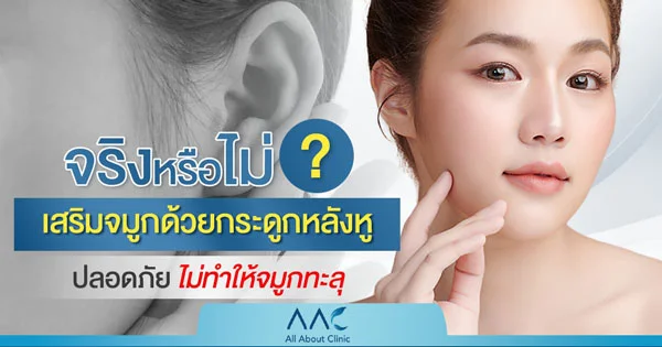 เสริมจมูกด้วยกระดูกหลังหู