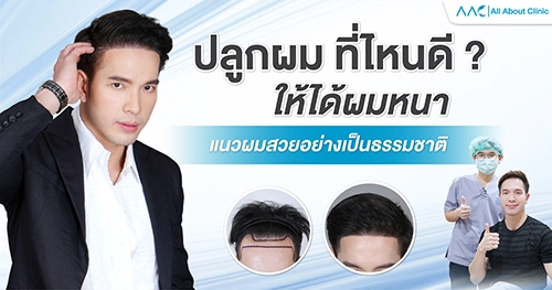 ปลูกผม ที่ไหนดี