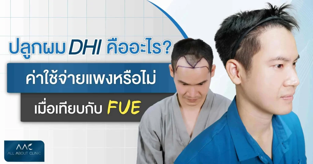 ปลูกผม Fue