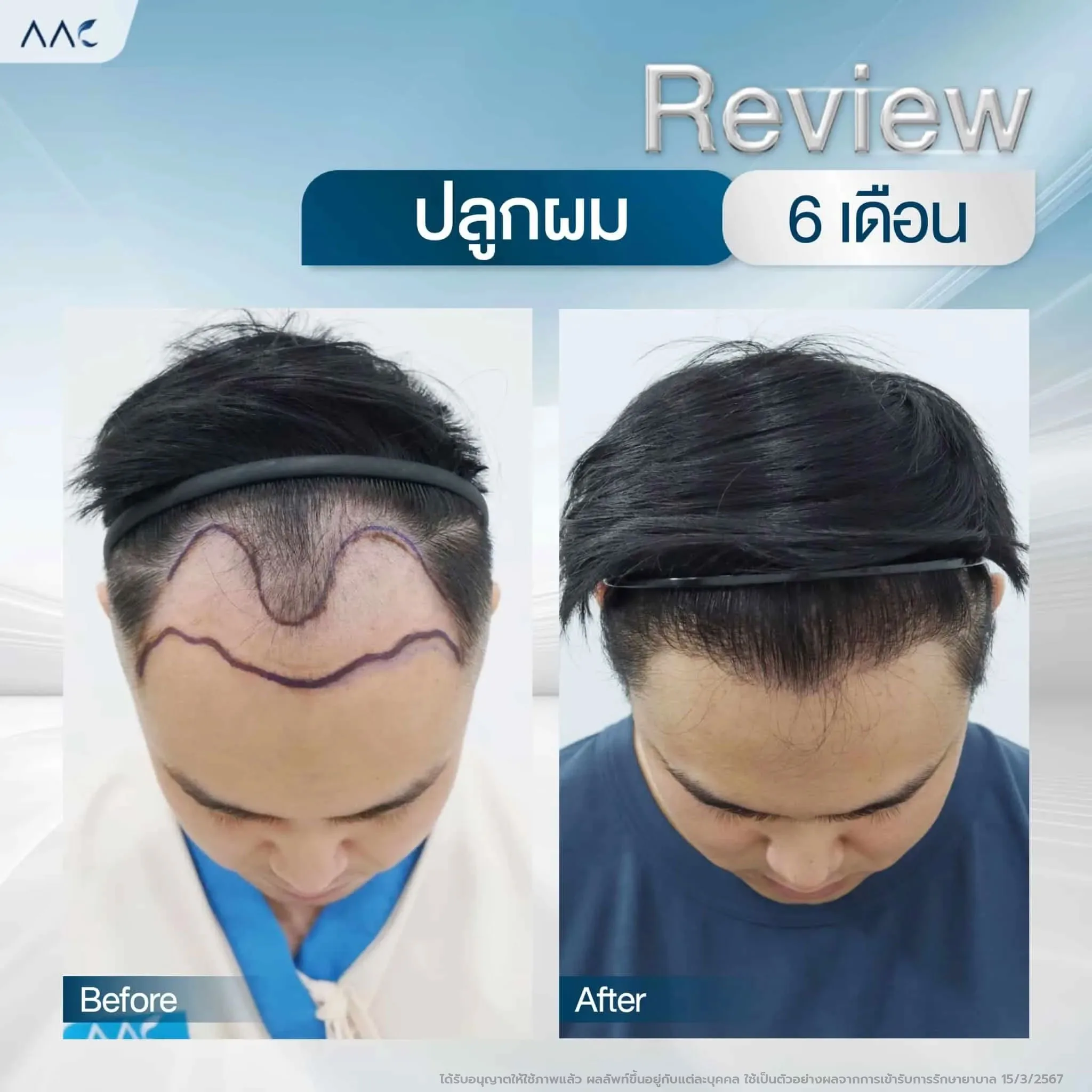 hycbldfjhaw6vq0yapkd