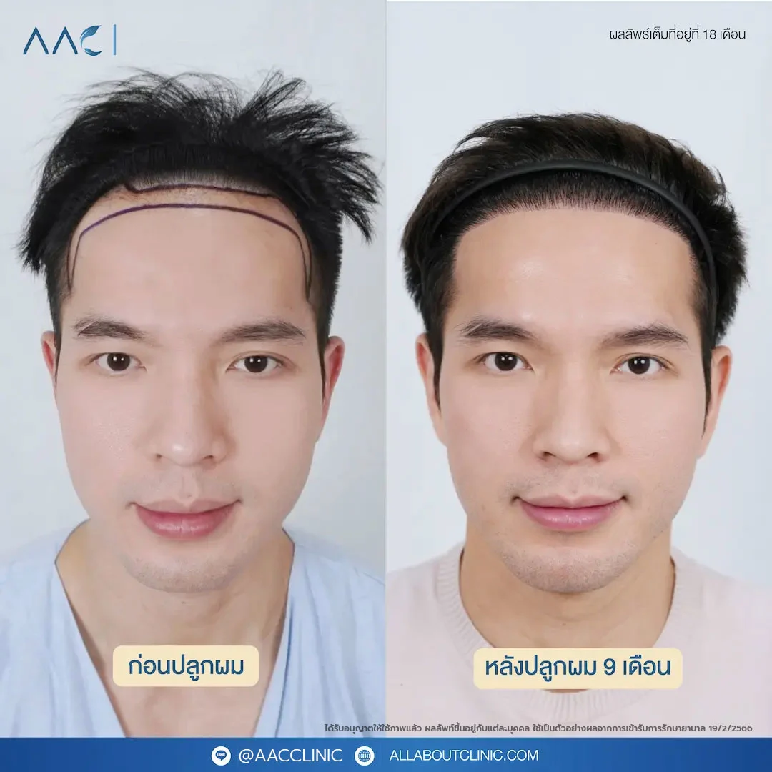 wqzjldijkmpko0zlttc8