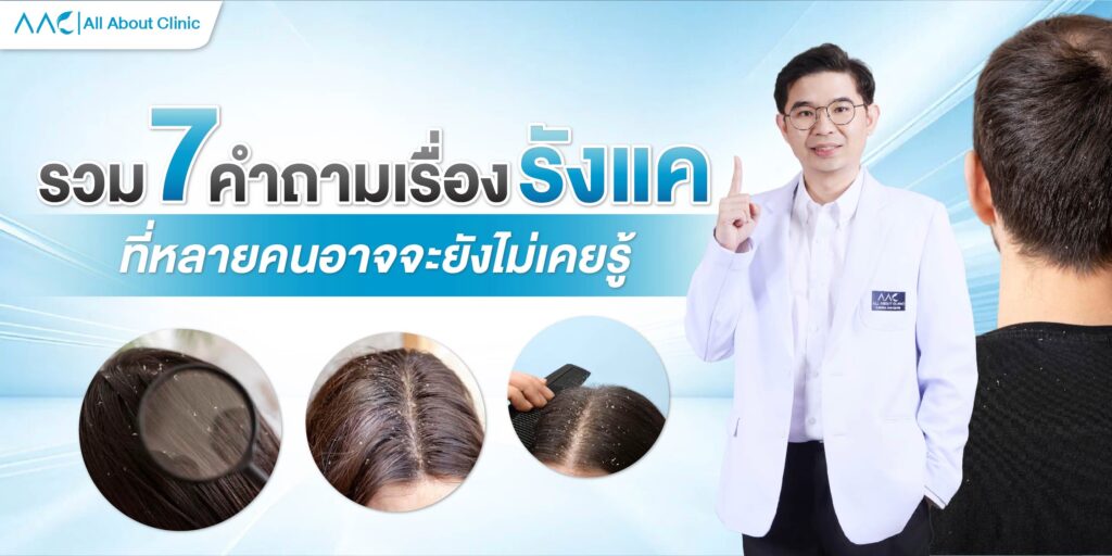 รังแค เกิดจาก อะไร ?