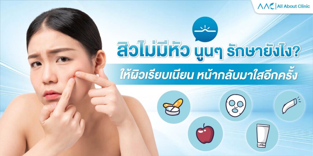 สิวไม่มีหัว นูนๆ รักษายังไง