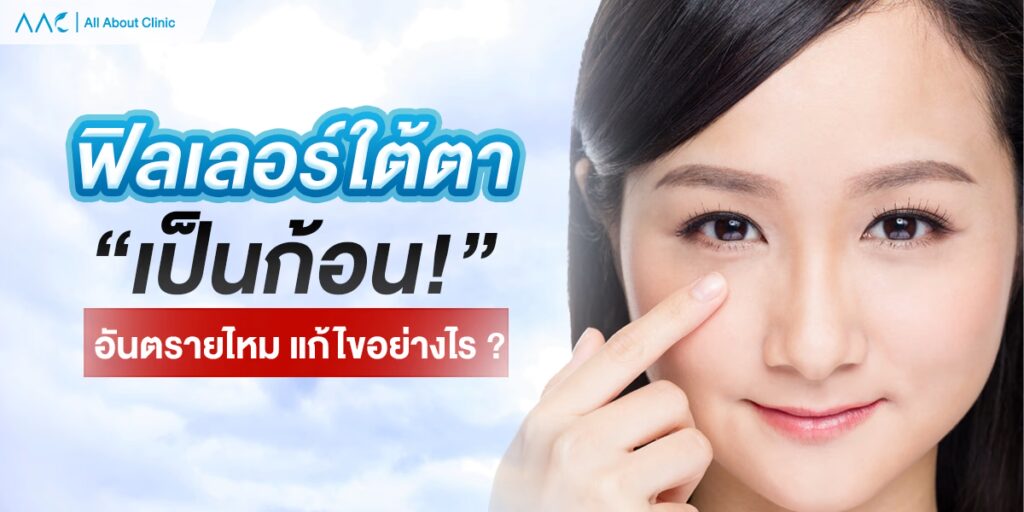 ฟิลเลอร์ใต้ตา เป็นก้อน